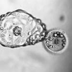 Hatching Blastocyst