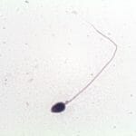 Normal Sperm