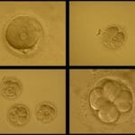 Early Embryo Development