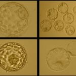 Morphologically Normal Blastocysts