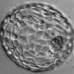 Hatched Blastocyst